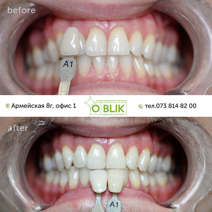 do-i-posle-2.jpg