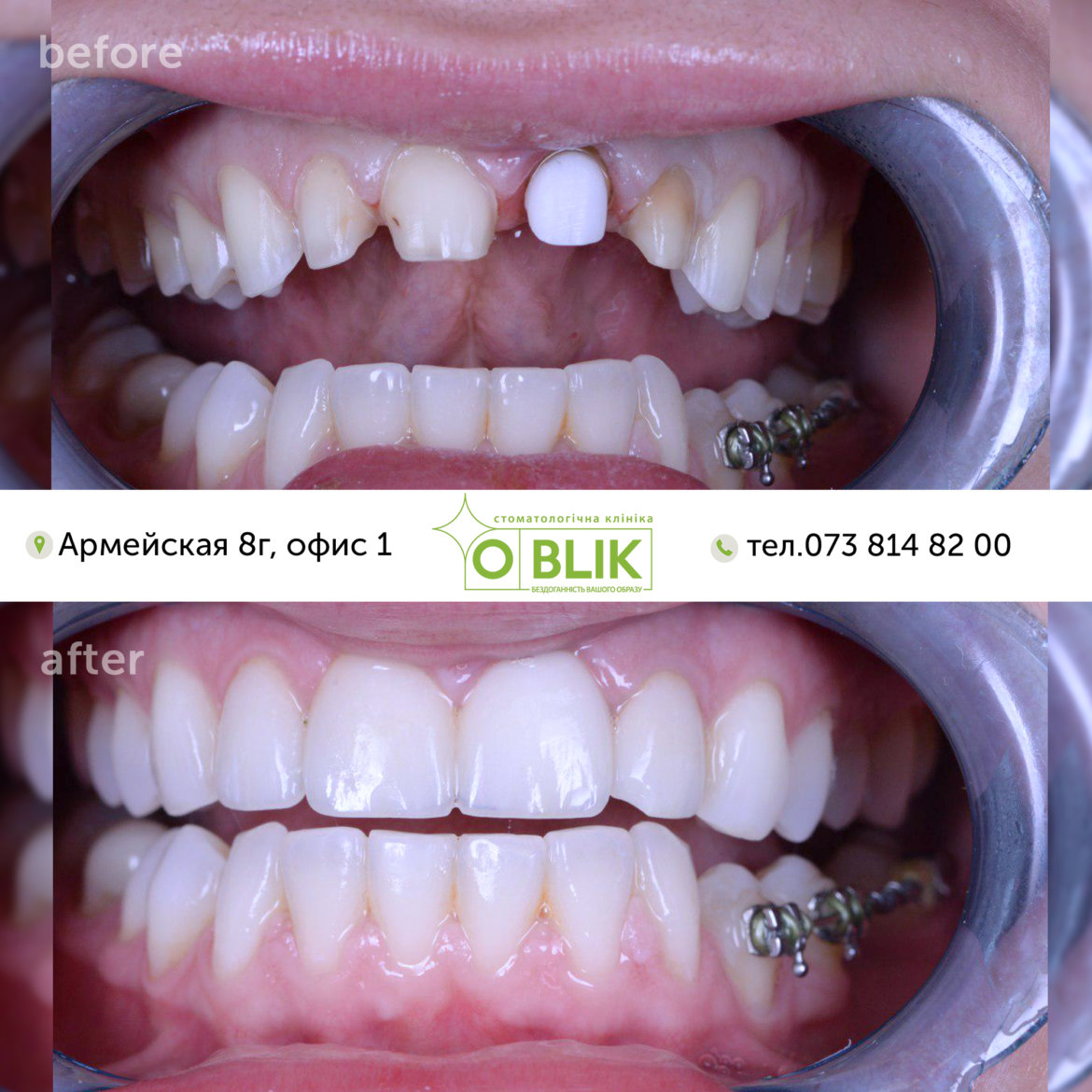before_after_shablon.jpg